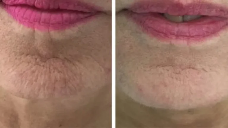 skin-care-product-img1