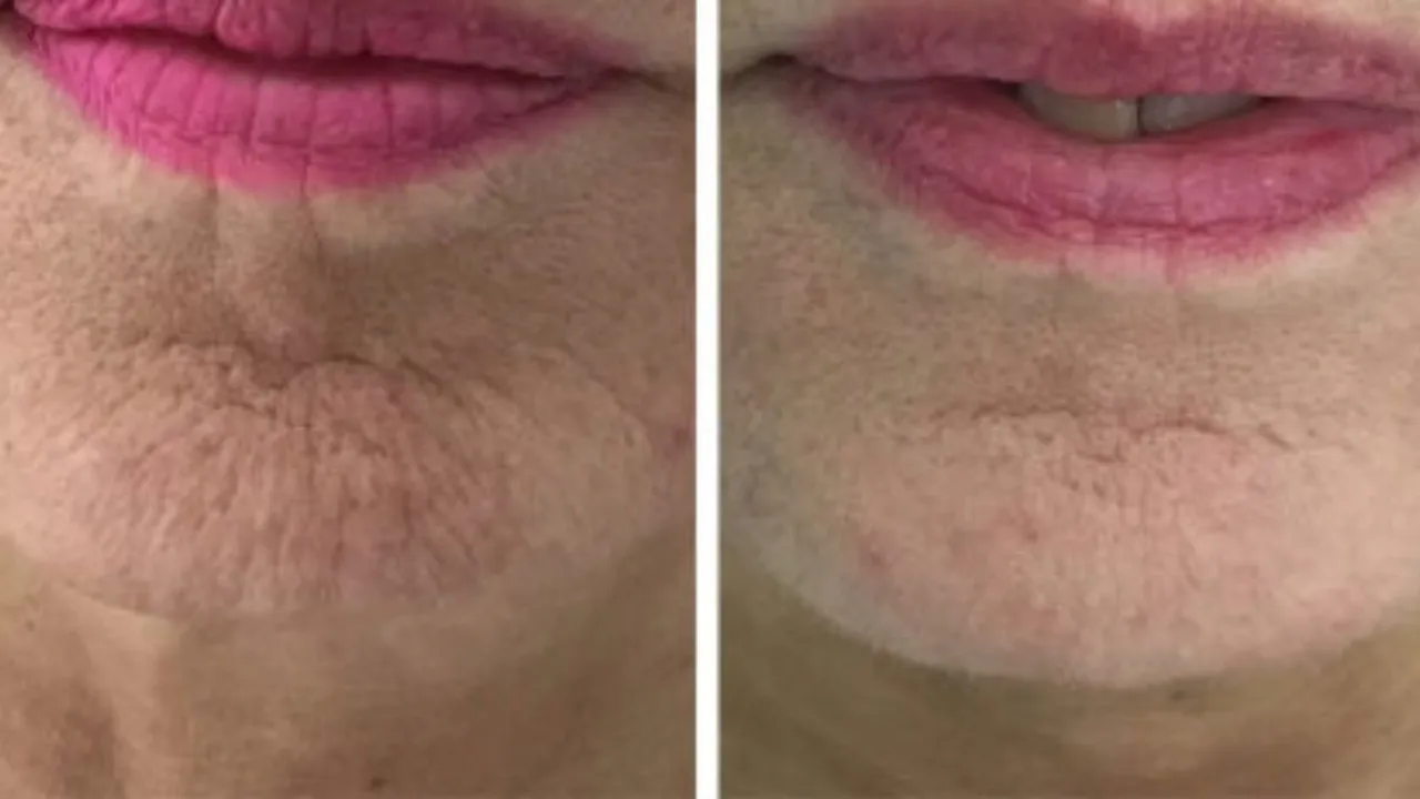 skin-care-product-img1