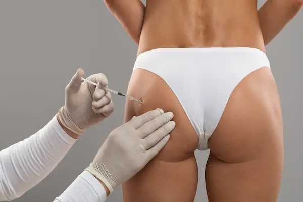 cellulite-injections-img2