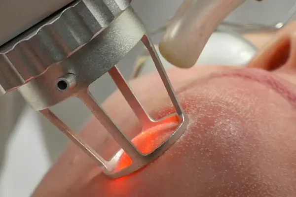co2-fractional-laser-img1