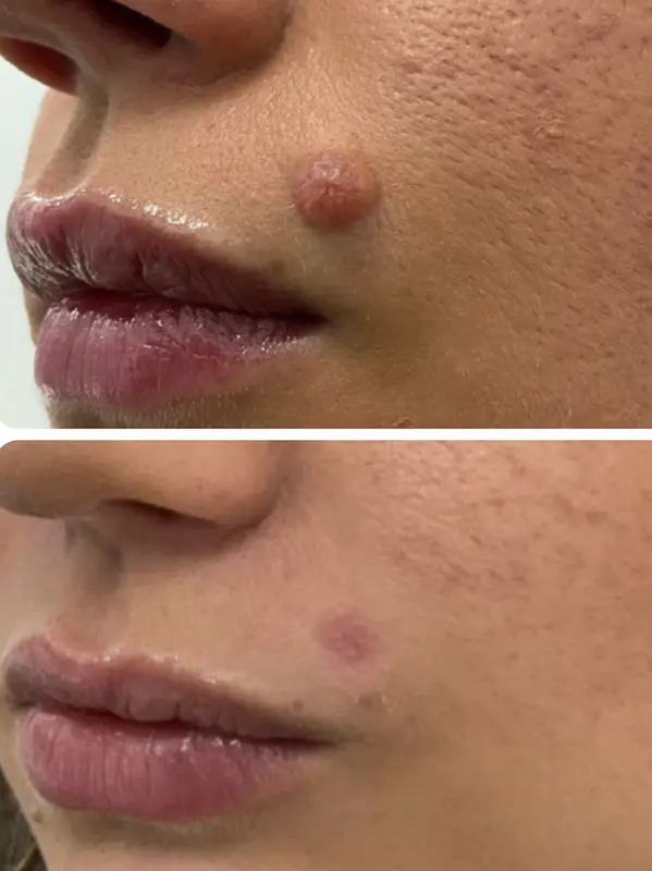 soft-surgery-plexr-gallery1