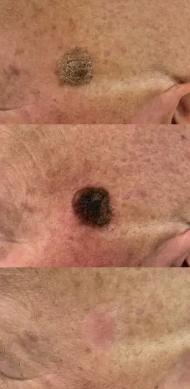 soft-surgery-plexr-gallery2